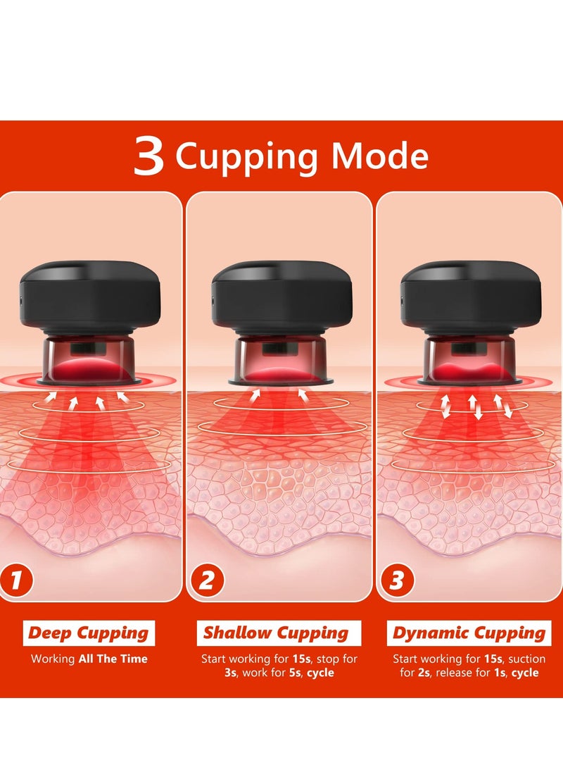 SYOSI Smart Dynamic Cupping Therapy Set, Remote Control Cupping Set with Red Light Therapy for Pain Relief, Recovery, Smart Cupping Therapy Massager with 3 Mode, 16 Level Temperature and Suction  - Image 5