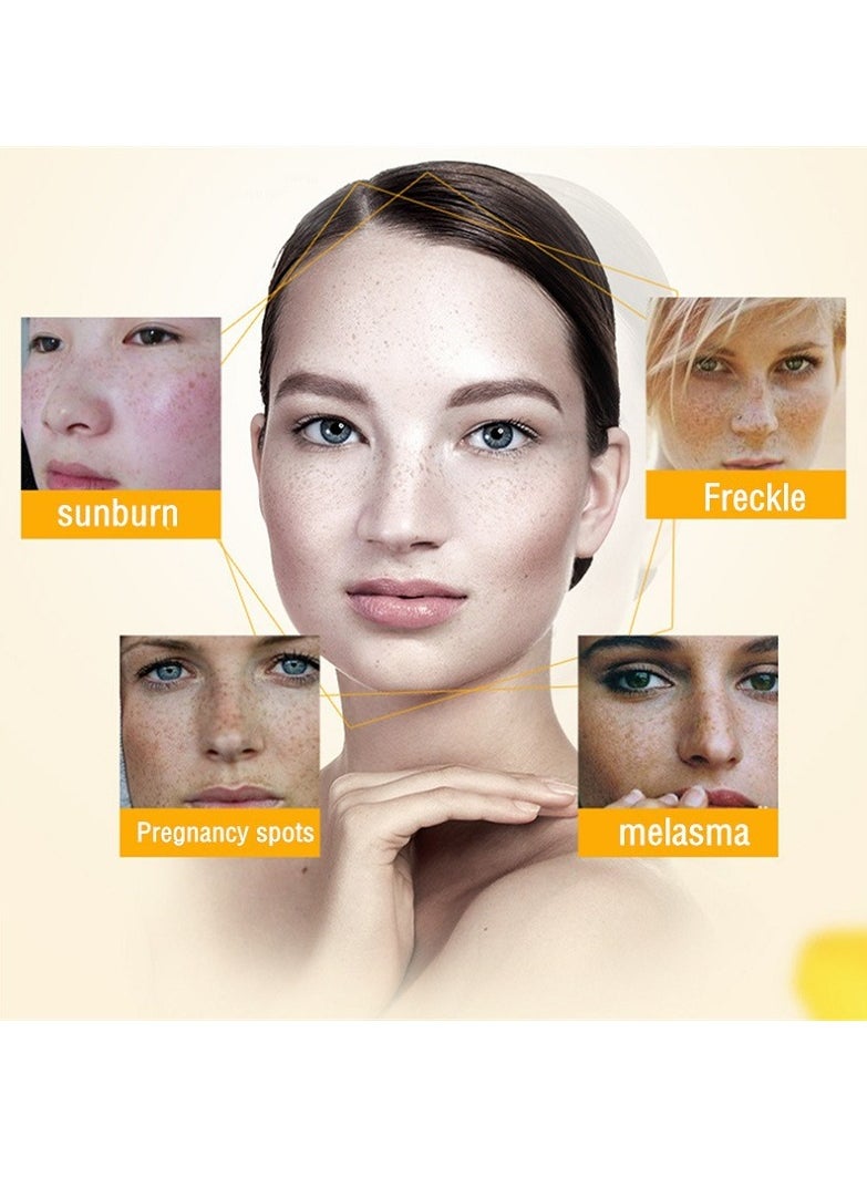 iBealee - Dark Spot Remove for Face Peeling Skin Whitening Freckle Cream Pigmentation Treatment Sun Spots Blemish Remover Lightening Cream - Image 1