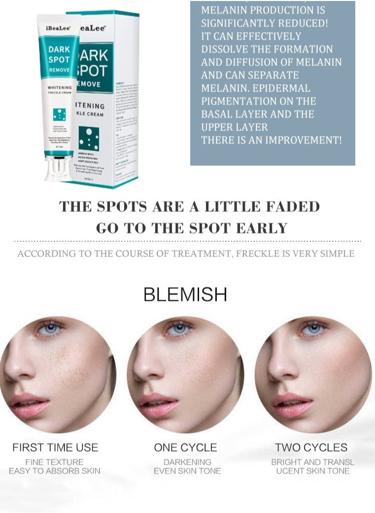 iBealee - Dark Spot Remove for Face Peeling Skin Whitening Freckle Cream Pigmentation Treatment Sun Spots Blemish Remover Lightening Cream - Image 1