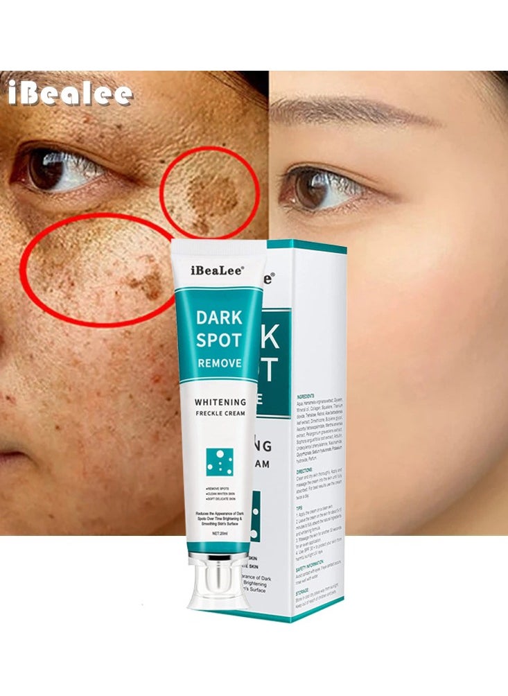 iBealee - Dark Spot Remove for Face Peeling Skin Whitening Freckle Cream Pigmentation Treatment Sun Spots Blemish Remover Lightening Cream - Image 1