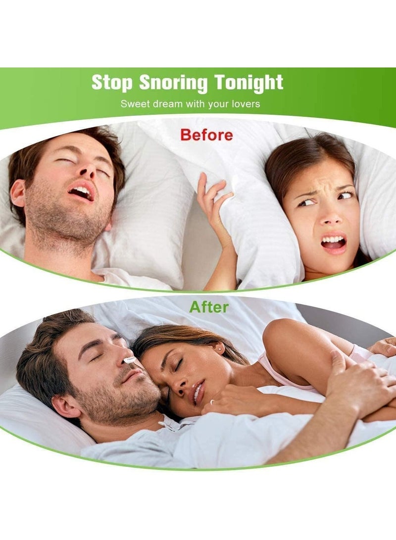 سيوسي أجهزة مكافحة الشخير ، سدادة كهربائية أوتوماتيكية للشخير لينة مزدوجة إيدي لتحسين جودة النوم USB صغير لمنع الشخير ، هواء منعش ، تنفس مريح للنوم للنساء والرجال (أبيض) - Image 2