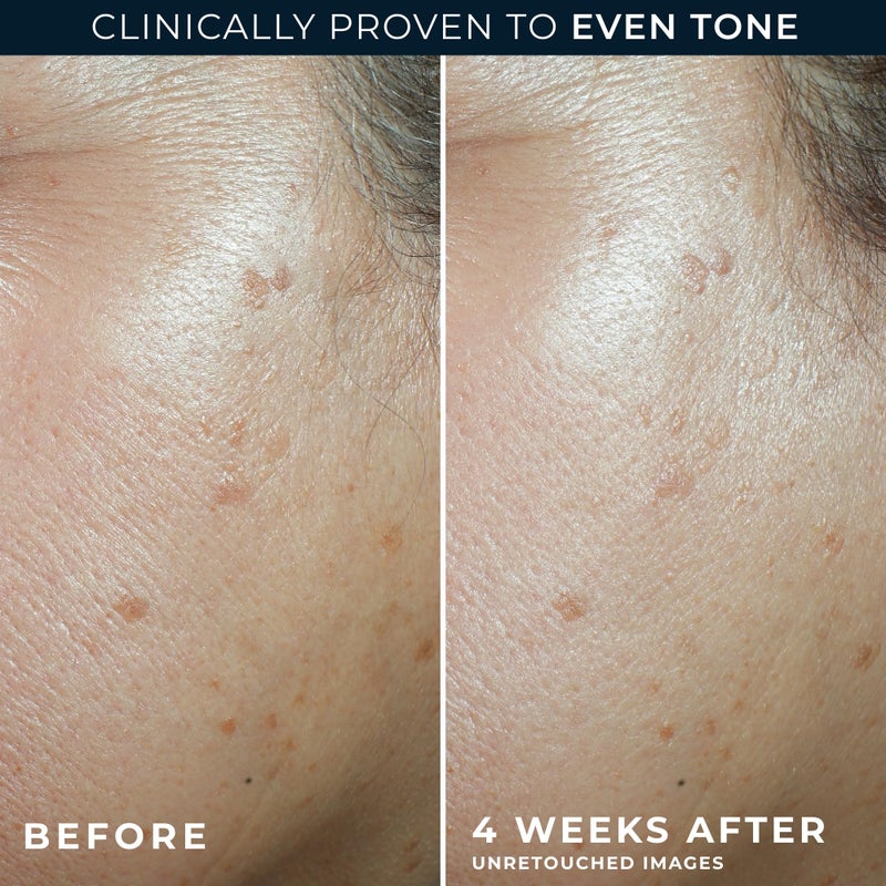 RoC مرطب يومي مضاد للشيخوخة 5 في 1 من روك مع واقي شمس واسع الطيف SPF 30 وزبدة الشيا، روتين العناية بالبشرة، 1.7 أونصة - Image 5