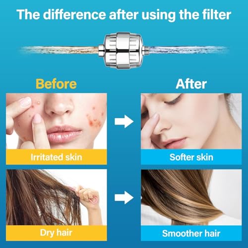 Prokart Pro Shower and Tap Filter for Hard Water with 15 Stage | Hard Water Softener for Bathroom | Strengthen Skin & Hair | Reduce Hair Fall & Skin Dryness | Hard Water Softner | (Pack of 1,chrome) - Image 5