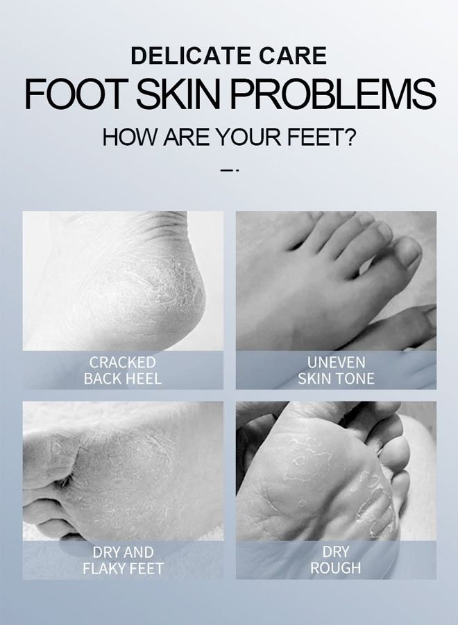 SADOER Lavender Essence Exfoliating Foot Mask Moisturizes  - Image 5