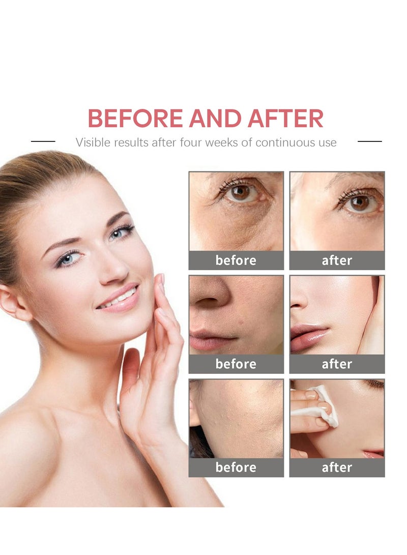 Jaysuing 5 In 1 Moisturizing Whitening Facial Cream, With Hyaluronic Acid Niacinamide Collagen Vitamin , Fast Absorbing Dark Spot Corrector Cream, Anti Wrinkles Cream For Age Defying Beauty 50g - Image 4