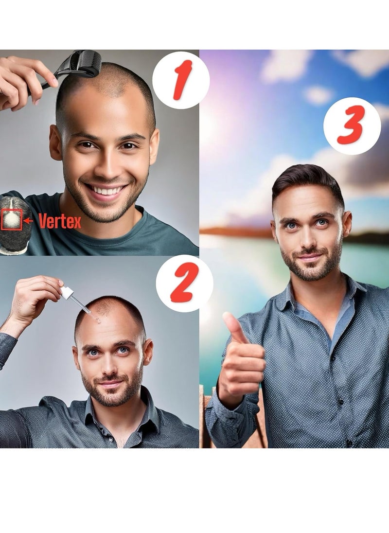 Kirkland Signatur - (6 Pack) Kirkland Minoxidil for Men Hair Regrowth Treatment, Liquid Extra Strength 5% Topical Solution, 6 Months Supply - Dropper Applicator and Microneedle Roller Included - Minoxidil Kirkland - Image 1