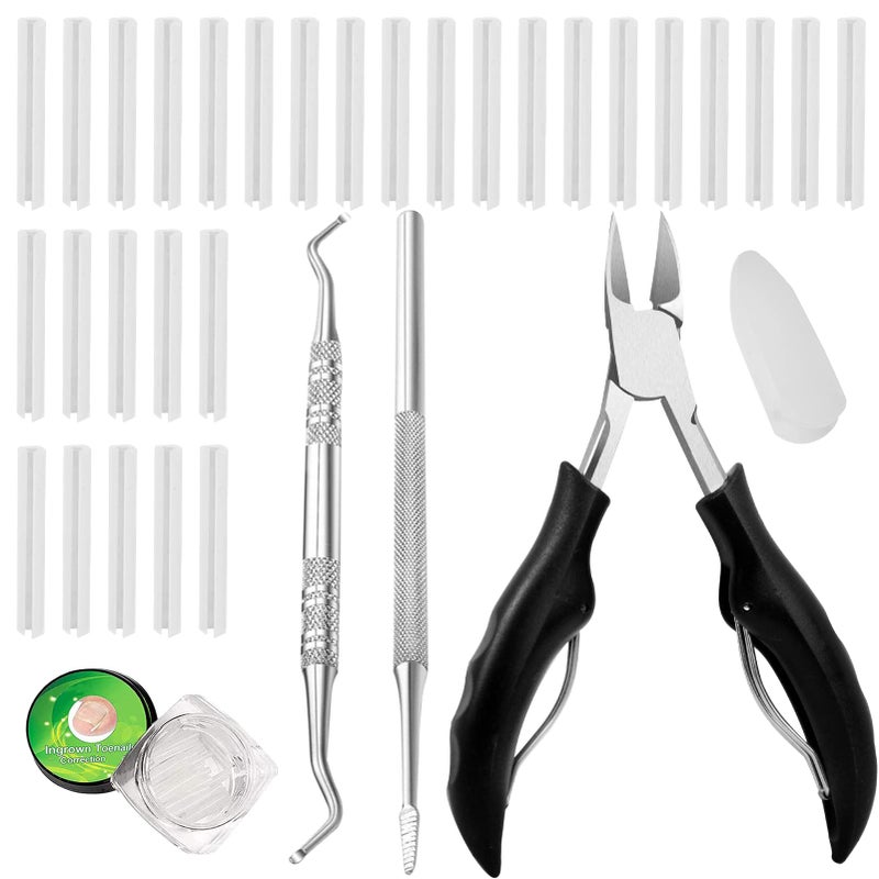 303 Pack Ingrown Toenail Correction Treatment Kit Professional Podiatrist Toenail Clippers 30PCS Ingrown Toenail Treatment Corrector Strip with 2PCS Ingrown Toenail Lifter and File