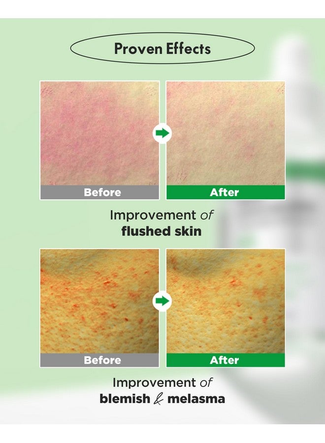 ويليدج أمبولة Real Cica Calming Trouble Ampoule، مصل مهدئ كوري 95% Madecassoside مهدئ سريع للاحمرار، التحكم في الدهون، يحسن النمش والعيوب للبشرة المعرضة لحب الشباب، 1.69 أونصة سائلة - Image 3