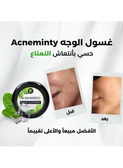 deoc Acneminty Facial Cleanser  - Image 4