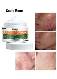 Acne Treatment Face Cream, Acne Spot Treatment for Face & Acne Dots, Natural Cystic Acne Treatment, For All Skin Types, Premium Acne Scar Cream & Pimple Remover - 30ML