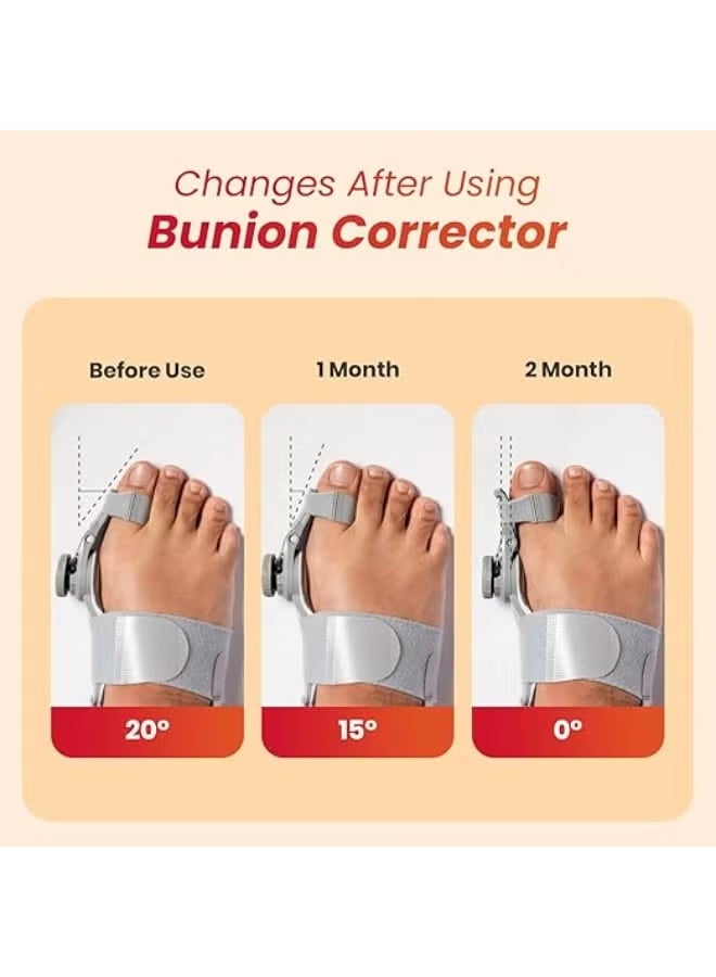 Orthopedic Bunion Corrector with Adjustable Rotating Knob - Toe Straightener for Foot Alignment & Pain Relief - Soft Silicone Layer & Multi-Angle Correction - Image 3