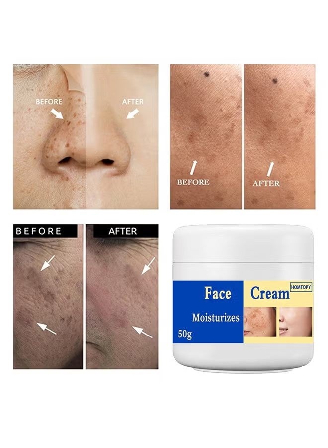HOMTOPY Face Cream, Dark Spot Remover for Face, Melasma Treatment, Hyperpigmentation Corrector, Spot Cream with Vitamin C and Glycerol, Fades Sun Spots and Freckles for Even Skin Tone 50g - Image 5