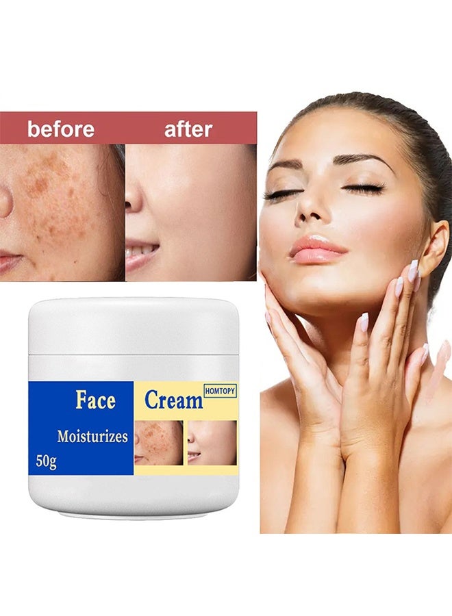 HOMTOPY Face Cream, Dark Spot Remover for Face, Melasma Treatment, Hyperpigmentation Corrector, Spot Cream with Vitamin C and Glycerol, Fades Sun Spots and Freckles for Even Skin Tone 50g - Image 1