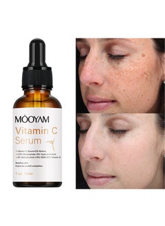 Vitamin C Serum - Brightening Skin Corrector for Face with Vitamin C and Hyaluronic Acid Boost Skin Collagen Hydrate and Plump Skin Anti Aging and Wrinkle Facial Serum 30ml