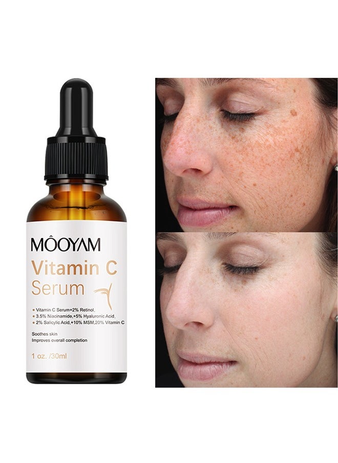 MOOYAM - Vitamin C Serum - Brightening Skin Corrector for Face with Vitamin C and Hyaluronic Acid Boost Skin Collagen Hydrate and Plump Skin Anti Aging and Wrinkle Facial Serum 30ml - Image 1