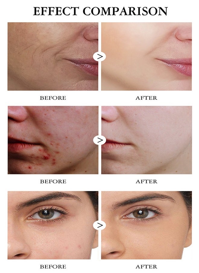 MOOYAM - Vitamin C Serum - Brightening Skin Corrector for Face with Vitamin C and Hyaluronic Acid Boost Skin Collagen Hydrate and Plump Skin Anti Aging and Wrinkle Facial Serum 30ml - Image 1