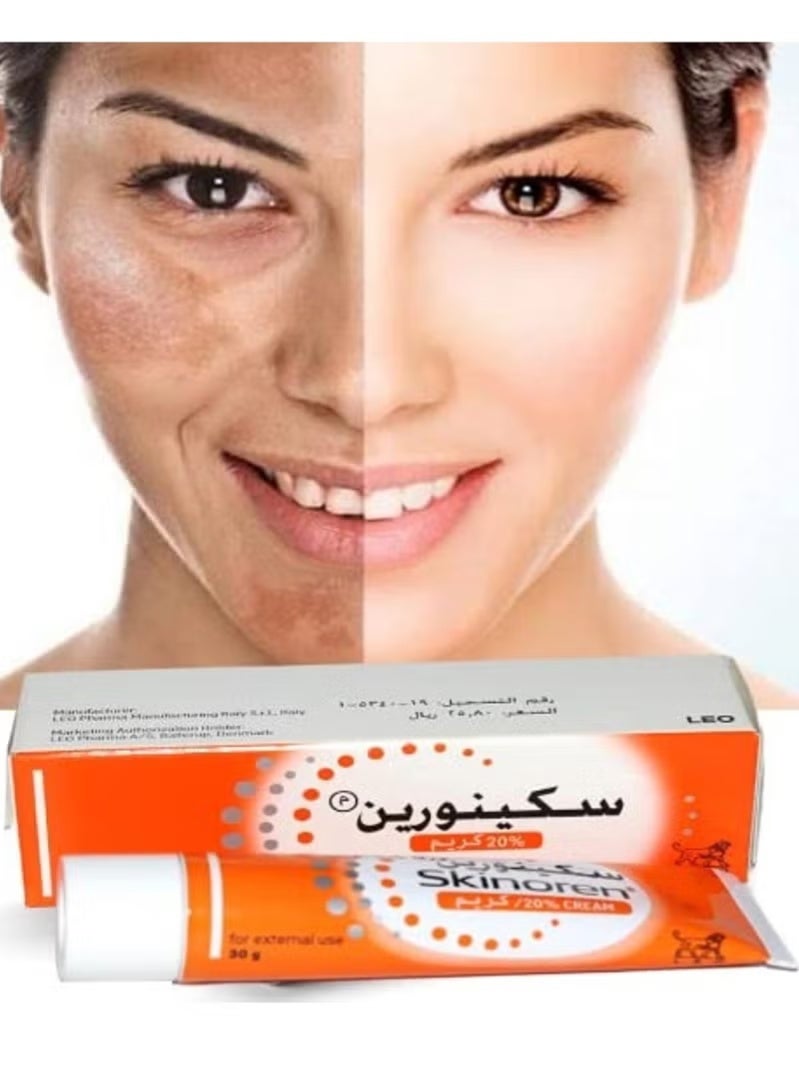 Skinoren Anti Acne Treatment Cream 30g - Image 2