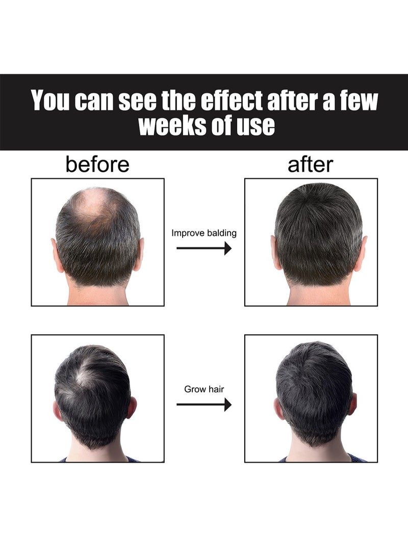 إيست مون زيت خلاصة الشعر، زيت أساسي للعناية بالشعر لتعزيز نمو الشعر الصحي وتقليل التجعد للشعر الجاف الخفيف والتالف للرجال 30 مل - Image 3
