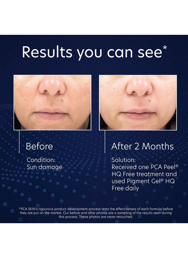 PCA SKIN PCA SKIN Hydroquinone-Free Pigment Gel Dark Spot Corrector, Dark Spot Serum for Brightening Dark Spots and Hyperpigmentation, Helps Even Skin Tone and Promote a Clear Complexion, 1.0 oz Pump  - Image 4
