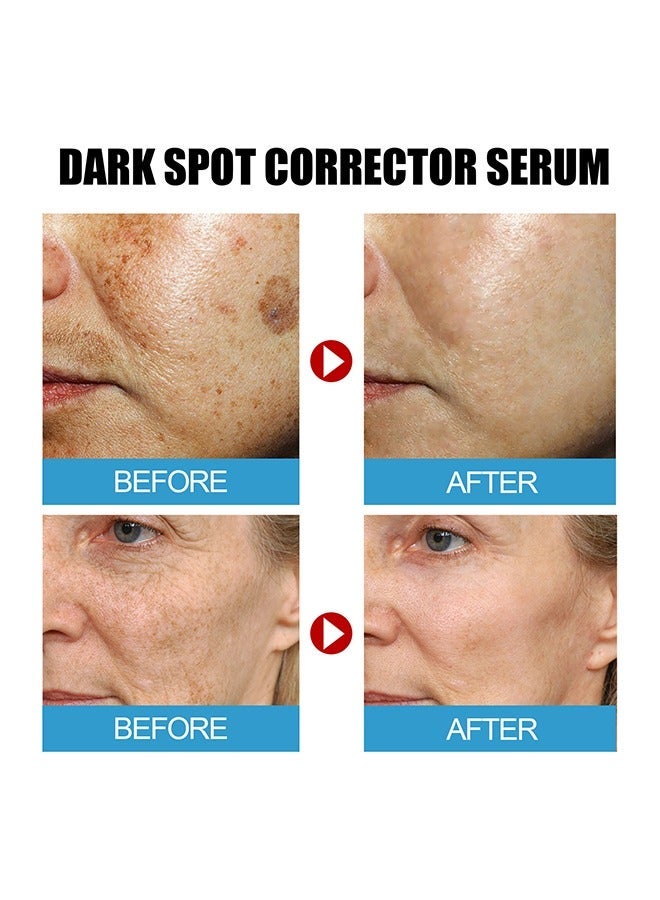 إيلهو مصل مصحح البقع الداكنة ، خلاصة كولاجين مشيمة الأغنام ، طاقة الجلد ، العناية بالوجه ، الترطيب ، مرونة الجلد ، تركيبة الرفع 30 مل[Tone Up Skin] 90% highly concentrated collagen ampoule makes your skin tight, supple, and moist again. Improve your skin texture and elasticity. - Image 3