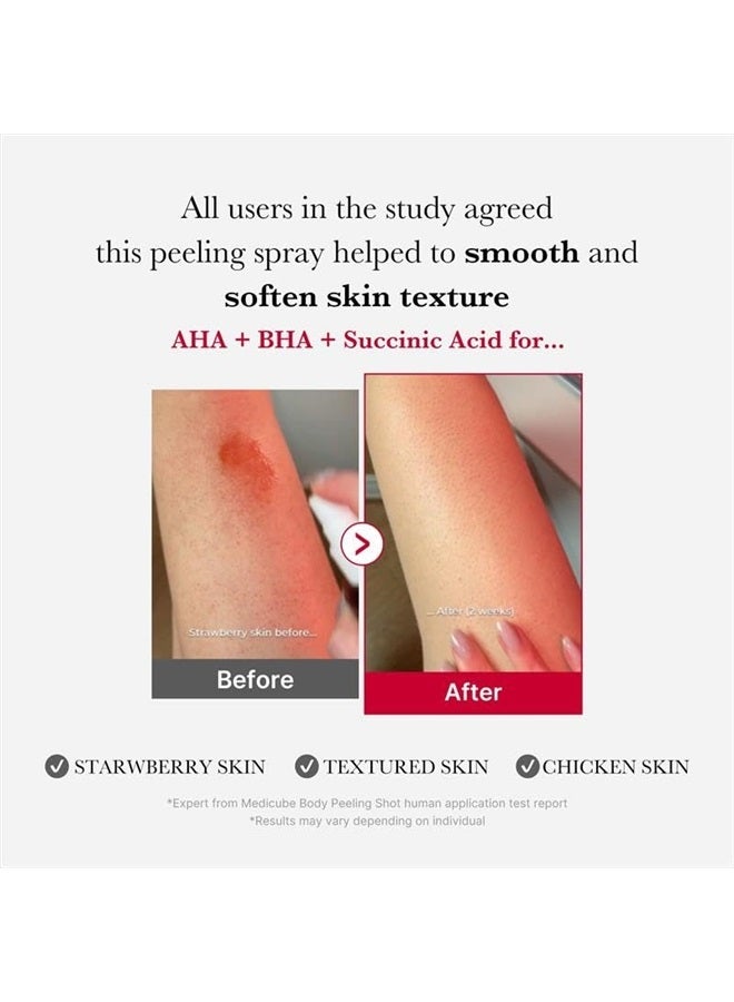 Medicube رذاذ تقشير الجسم الأحمر، رذاذ تنظيف الجسم بنكهة الفراولة، AHA + BHA + حمض السكسينيك، مقشر، 3.88 أونصة. - Image 2