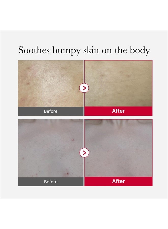 Medicube رذاذ تقشير الجسم الأحمر، رذاذ تنظيف الجسم بنكهة الفراولة، AHA + BHA + حمض السكسينيك، مقشر، 3.88 أونصة. - Image 4