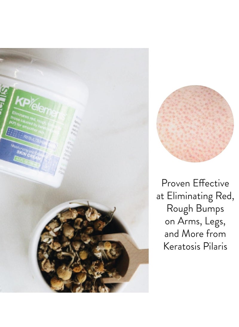 KP Elements KP Elements Keratosis Pilaris Lotion (4 fl oz) - Natural Keratosis Pilaris Treatment, Moisturizing & Exfoliating AHA Lotion for KP, Vegan, Made in USA  - Image 2