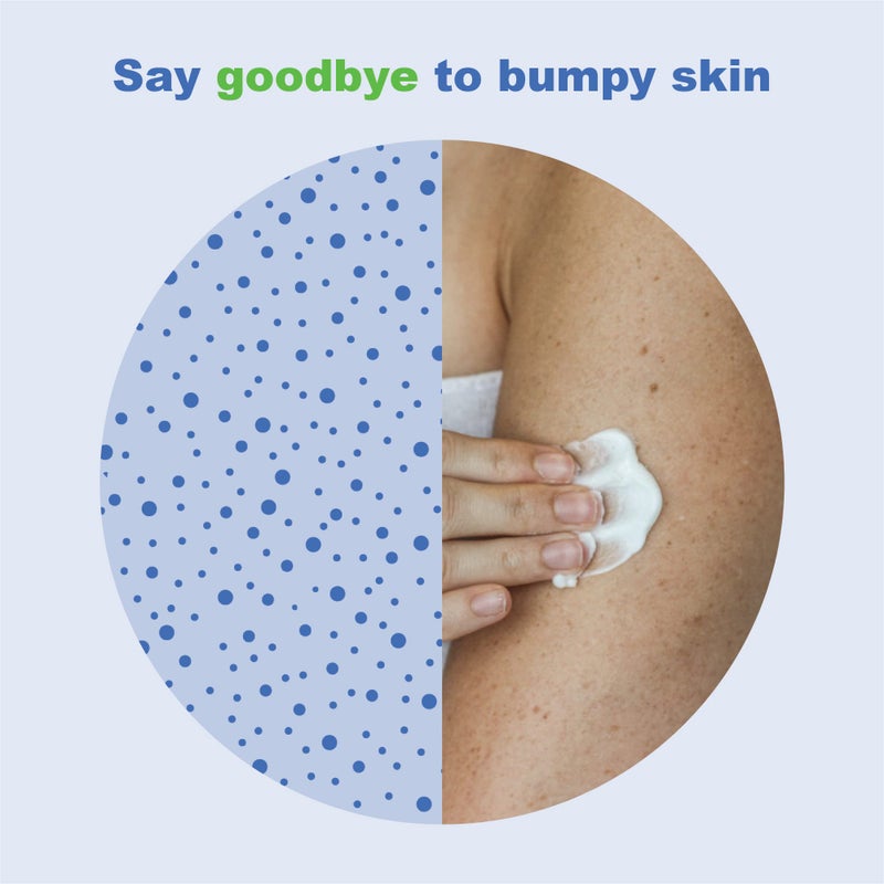 KP Elements لوسيون كي بي إليمنتس لعلاج الكيراتوزيس بيلاز (4 أونصة سائلة) - علاج طبيعي للكيراتوزيس بيلاز، لوسيون مرطب ومقشر AHA للكيراتوزيس بيلاز، نباتي، مصنوع في الولايات المتحدة الأمريكية - Image 3