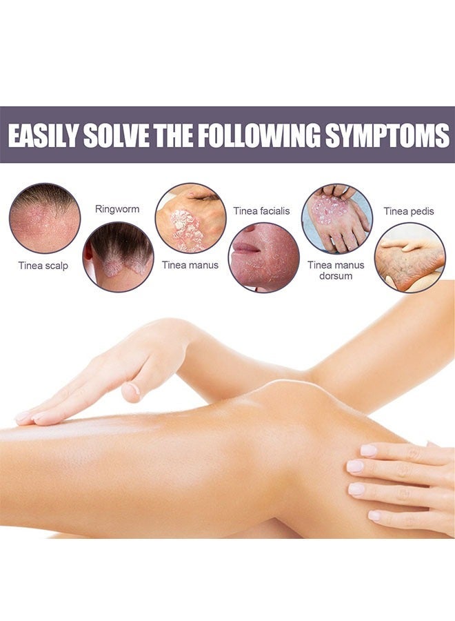 EELHOE Eczema and Psoriasis  Atomizing Spray 30ml, Hand and Foot Moss Skin Repair, Relieve Itching, Skin care and Jiejia spray, Antibacterialnot Irritating Safety - Image 3