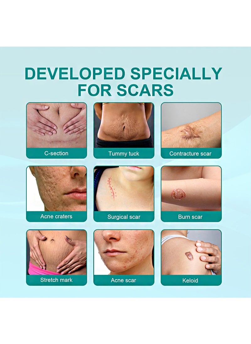 SOUTH MOON - 20g Medical Grade Scar Spray，Scar Removal Advanced Scar Spray for all types of scars, surgical scars and stretch marks (2 PCS) - Image 1