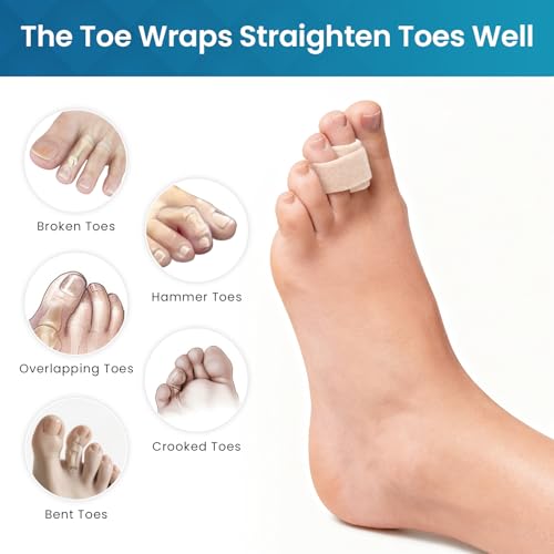 Kimihome Hammer Toe Corrector for Women & Men - Reusable Fabric Broken Toe Wraps - Hammertoe Straightener - Toe Splints for Bent, Curled, Crooked, Claw Toes (4 Large + 4 Small, Beige) - Image 4
