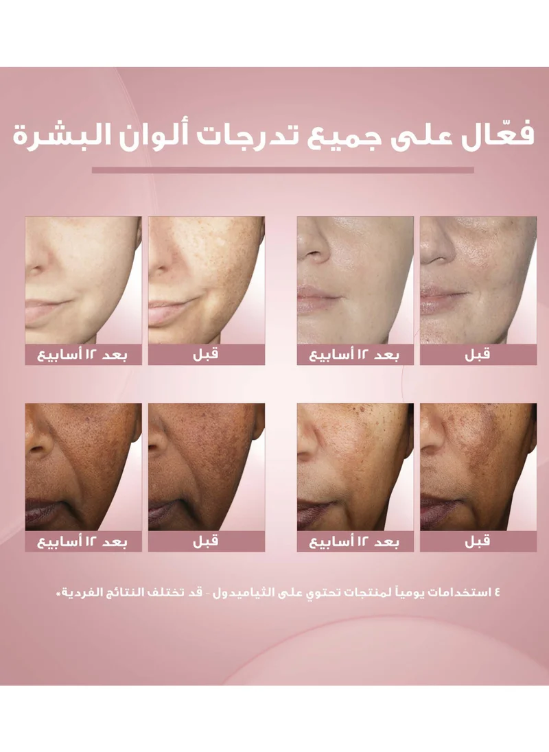 يوسيرين كريم يوسيرين ايفن بيغمنت بيرفيكتور الليلي 50 مل