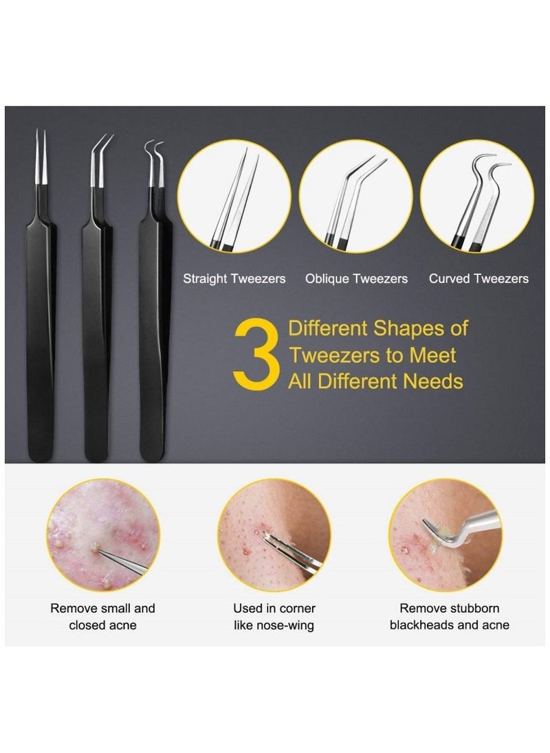 Blackhead Remover Tool 10 Pcs Professional Pimple Extractor Tool Acne Removal Kit - Treatment for Pimples Blackheads Zit Removing Forehead Facial and Nose
