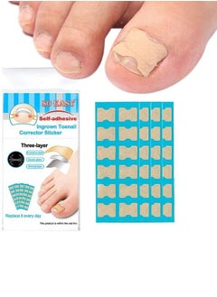 McDou Ingrown Toenails Phomnd Ingrown Toenail Corrector Sticker 120 piece  - Image 3