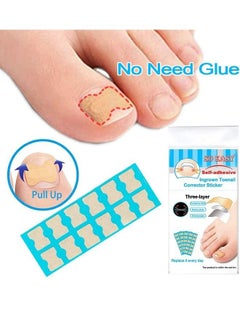 McDou Ingrown Toenails Phomnd Ingrown Toenail Corrector Sticker 120 piece  - Image 2