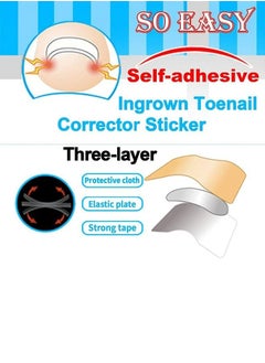 McDou Ingrown Toenails Phomnd Ingrown Toenail Corrector Sticker 120 piece  - Image 5