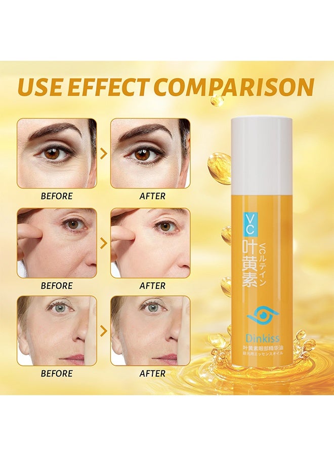 دينكيس زيت جوهر العين اللوتين ، زيت خلاصة العين اللوتين ، مصل العين اللوتين ، زيت العين اللوتين ، كرة الأسطوانة للزيت تحت العين ، مصل العين الياباني المضاد للشيخوخة لأكياس العين (8 مل) - Image 3