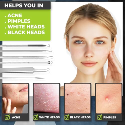 DERMATED [6 Pcs] Blackhead Remover Tools for Acne - Surgical Stainless Steel Pimple Popper Tool Kit, Comedones & Blemish Extraction Kit - Image 2