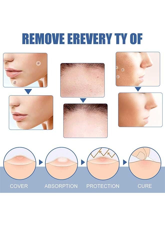 EELHOE - 144pcs Skin Tag Patches, Patch Design, Clean, Care, And Tender Skin, Painless, Easy To Use, Effective For Removing Warts, Flesh Moles, And Black Nevi, Suitable For Face And Body, Skin Label Remover - Image 1