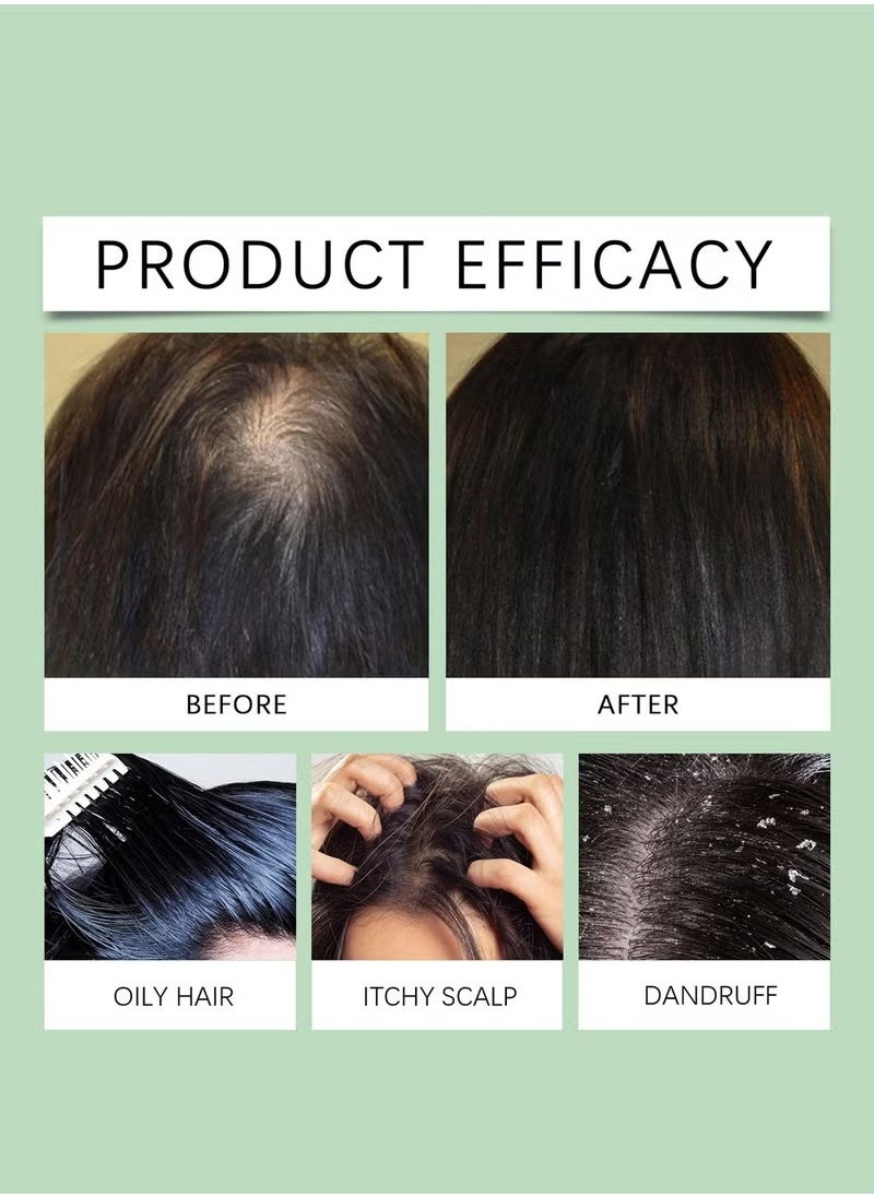 HOEGOA - Rosemary Scalp Scrub with Scalp Scrubber Set, Contains Rosemary, Peppermint Oil, and Petrel Ingredients Scalp Exfoliator Scrub, Scalp Cleanser for Relieve Scalp Itching, Exfoliate and Care for Scalp and Hair - Image 1