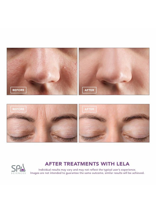 SPA SCIENCES سبا ساينسز - ليلّا - ملعقة وجه 4 في 1 لتنظيف عميق، استخراج المسام، حقن السيروم، مكافحة الشيخوخة ونحت الوجه - Image 4