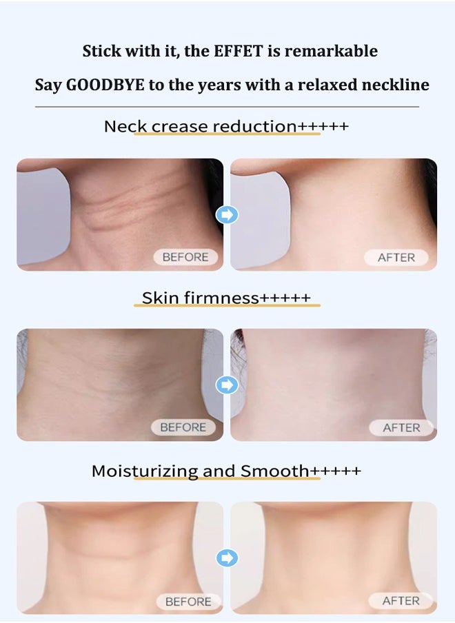 Firming Wrinkle Removal Device, Neck Face Lifting Tighten Massager, Anti Wrinkle Double Chin Remover, Fine Line Reducer