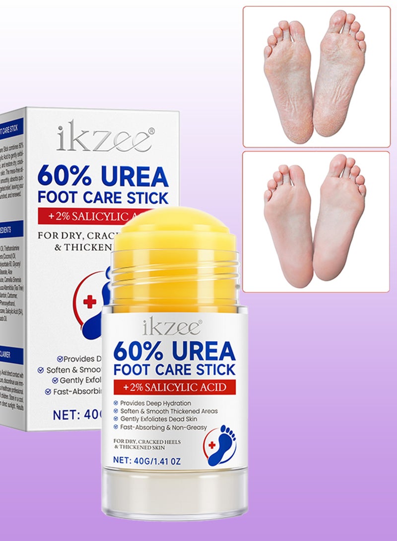 IKZEE 60% Urea Foot Care Stick + 2% Salicylic Acid Urea Cream for Dry Cracked Feet and Hands Heels Knees Elbows Hands Repair Treatment Balm Moisturizer and Corns Callus Remover Stick Cream Dead Skin Remover and Toenails Softener Stick 40g  - Image 1