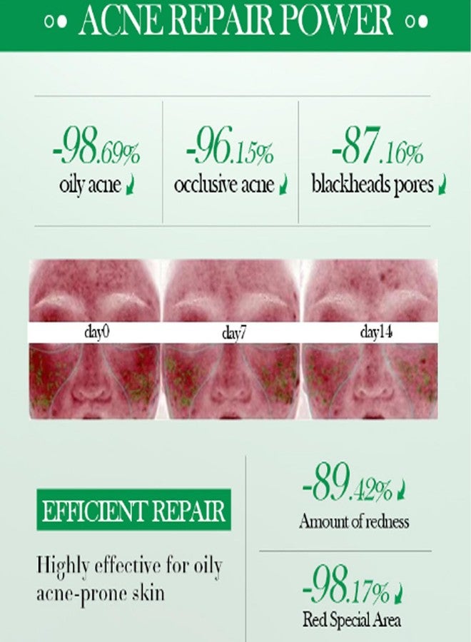 Grospe Salicylic Acid Repair Cream,Salicylic Acid Face Moisturizer,Pore Shrinkage Acne Skin Improves Acine Scars Motsturizing,Suitable for Oily, Acne Prone Skin 50g - Image 4