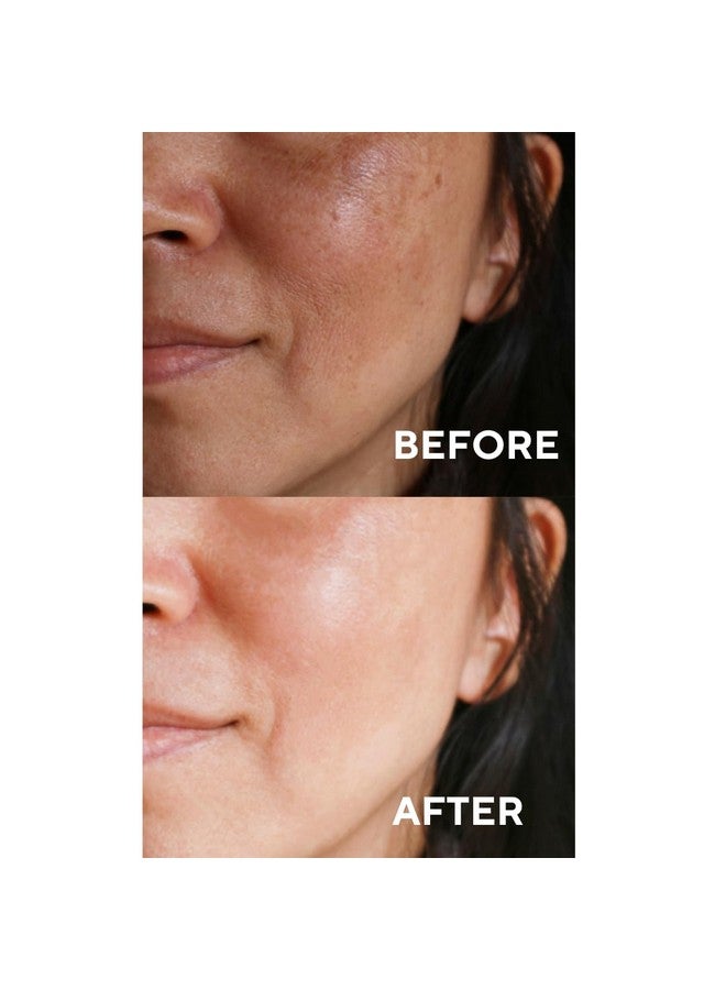 the CEEL Vitamin C Face Serum Brightening Moisturizing And Anti Aging Serum For Dark Spots Wrinkles Vitamin C Serum For Face With 20% Pure Vitamin C Ferulic Acid And Vitamin B5 1.Fl.Oz(30 Ml) - Image 3