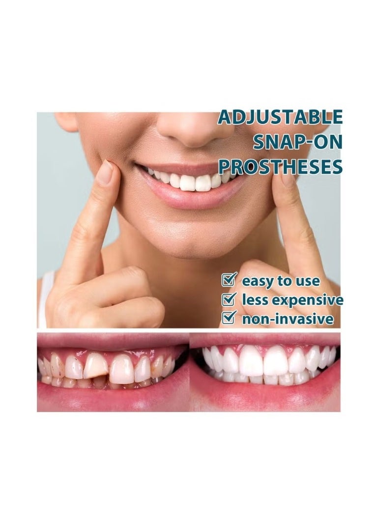 EELHOE Adjustable Snap on Dentures, Soft & Safe Material,Upper and Lower Jaw Cosmetic Denture Veneers, Temporary Dental Restoration Kit,Confident Smile  - Image 3