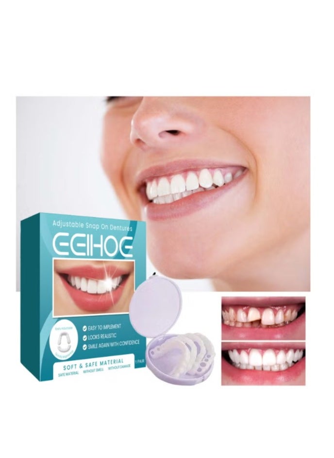 EELHOE Adjustable Snap on Dentures, Soft & Safe Material,Upper and Lower Jaw Cosmetic Denture Veneers, Temporary Dental Restoration Kit,Confident Smile  - Image 1