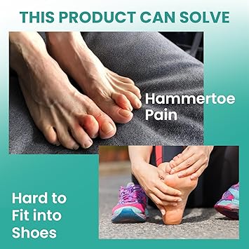 Welnove Hammer Toe Corrector Straightener Bunion Corrector Broken Toe Calluses Blisters 3 Different Size for Women and Men - Image 5