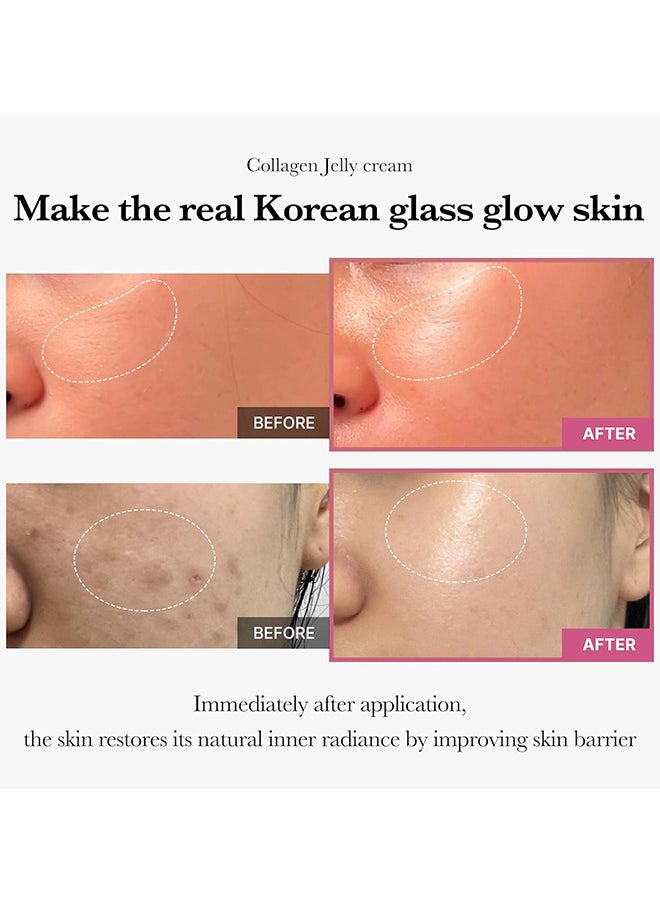 KOEC - Collagen Jelly Cream, Boost Elasticity And Hydration, Reduce Fine Lines And Dullness, 100ml - Image 1
