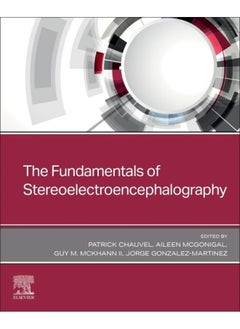 The Fundamentals of Stereoelectroencephalography 